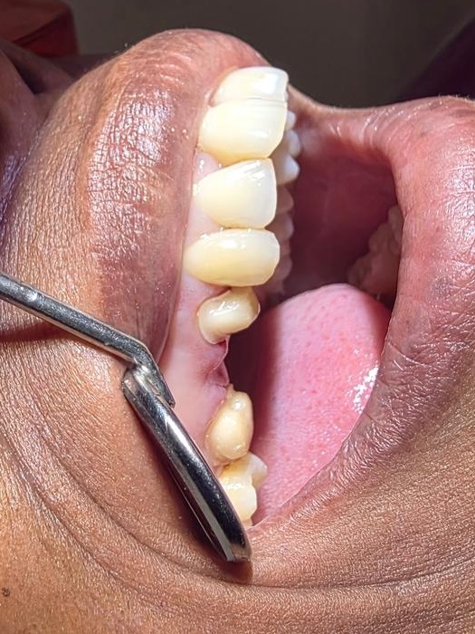 Before dental treatment result case 01