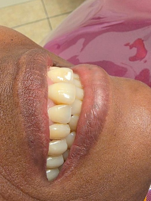After dental treatment result case 01